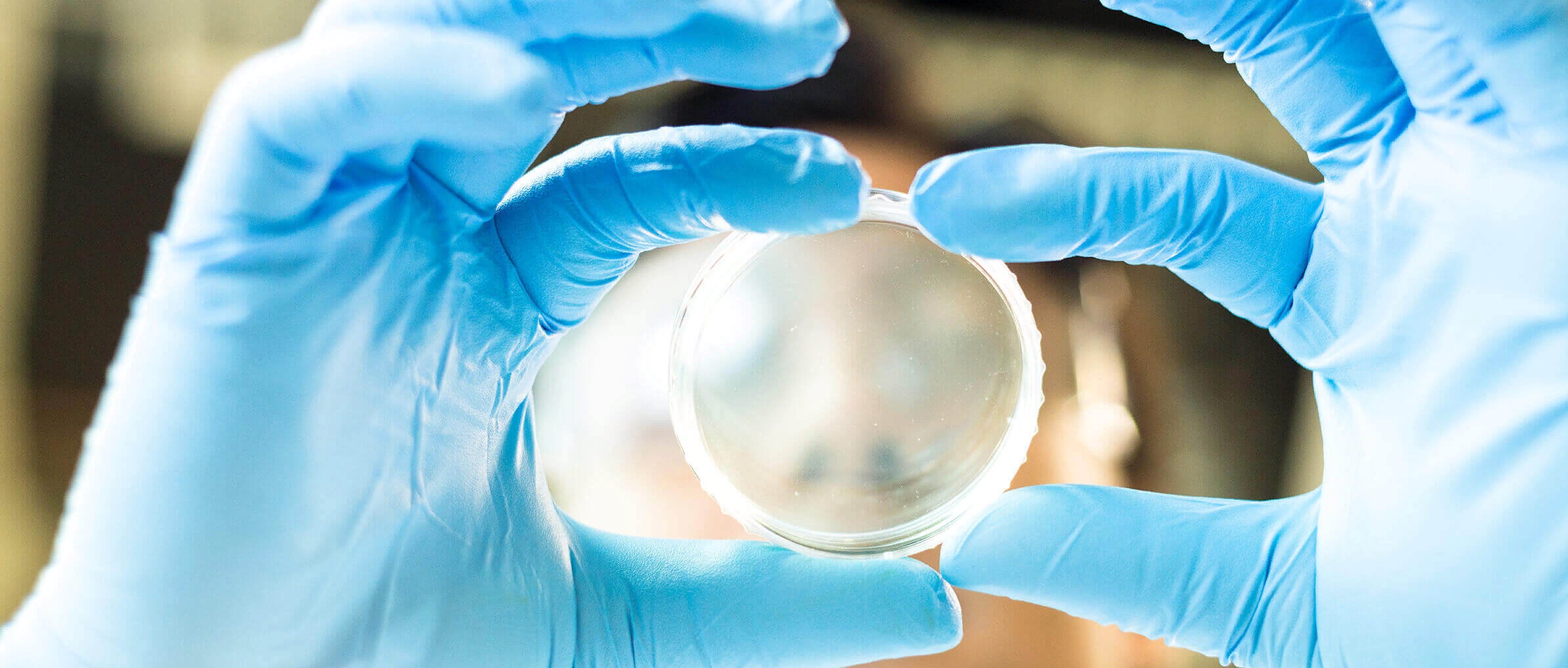 база доноров яйцеклеток с фото