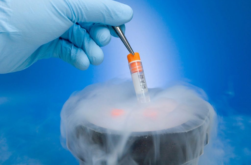 Что выбрать для ЭКО – донорские эмбрионы или ооциты